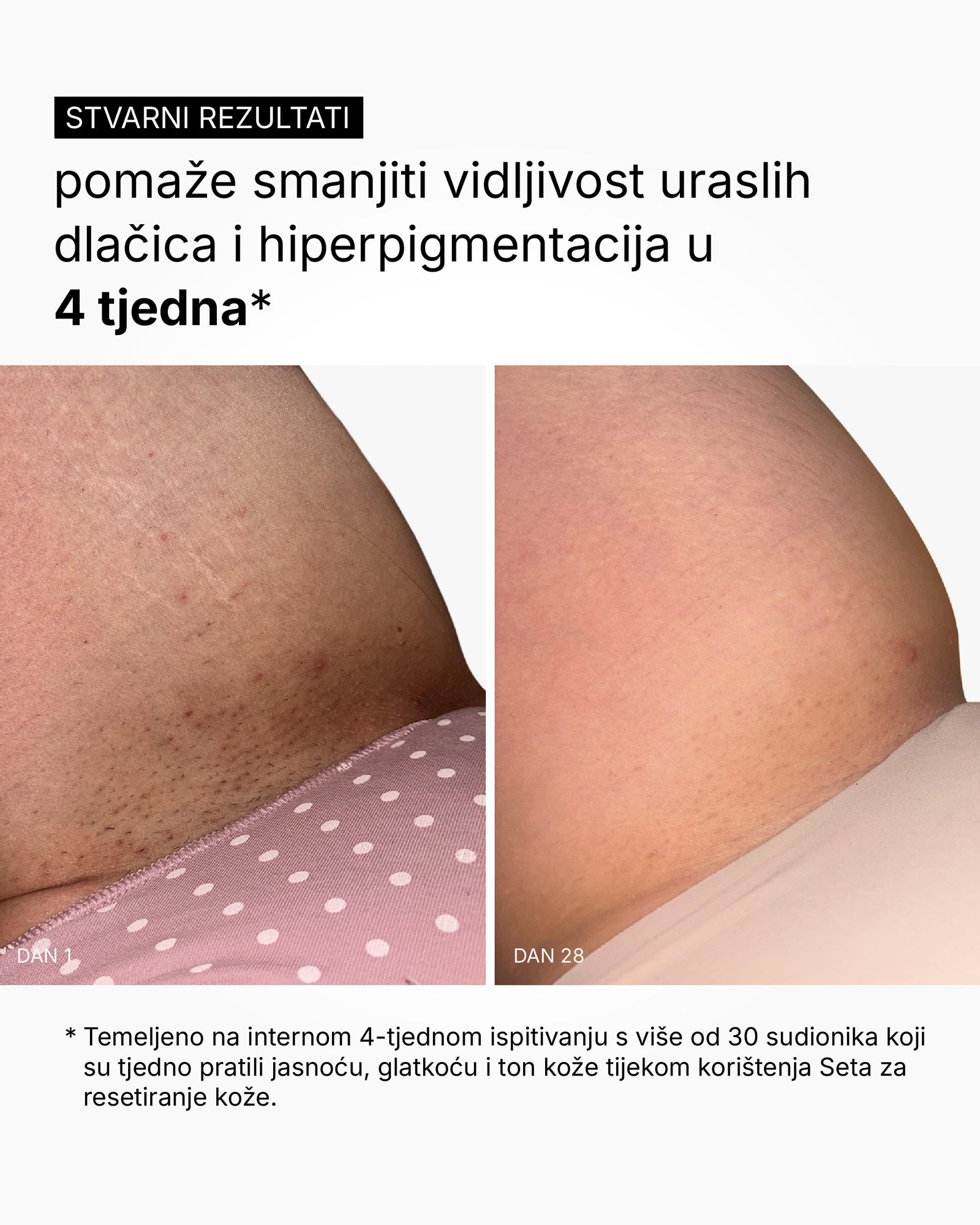 Skin Reset Set - Πλήρης ρουτίνα σώματος