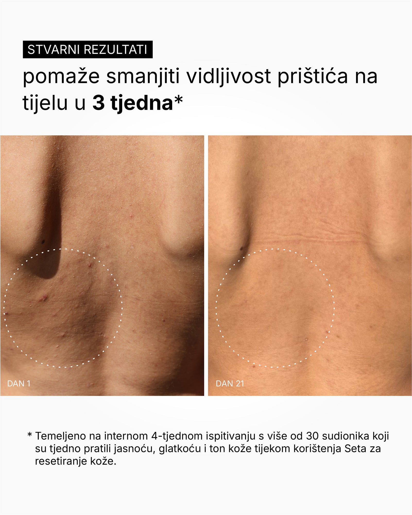 Skin Reset Set - Πλήρης ρουτίνα σώματος
