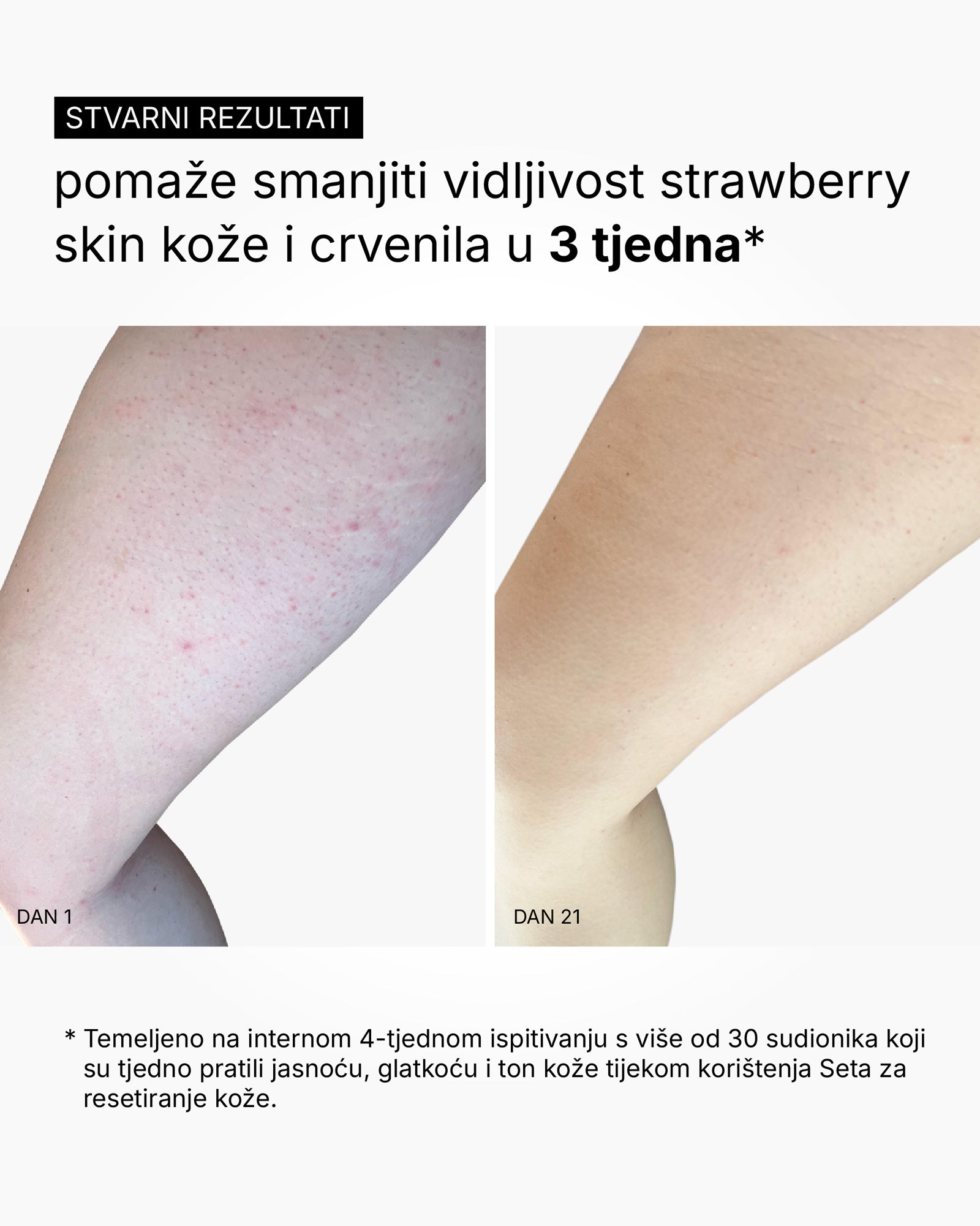 Skin Reset Set - Πλήρης ρουτίνα σώματος